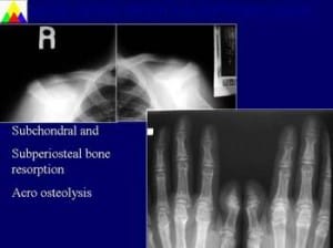 Slide11