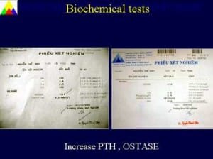 Slide14