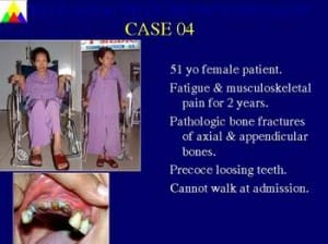 Slide17